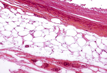 White adipose tissue, light micrograph